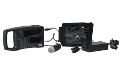 Ultralydsscanner